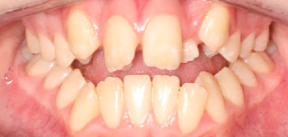 Before & Afters Before & Afters