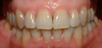 Before & Afters Before & Afters