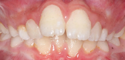 Before & Afters Before & Afters