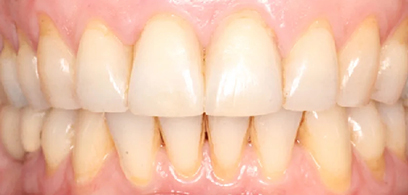 Before & Afters Before & Afters