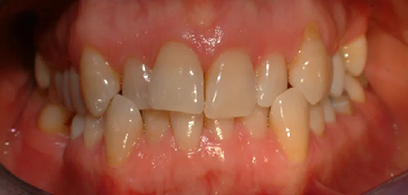 Before & Afters Before & Afters