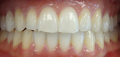 Before & Afters Before & Afters