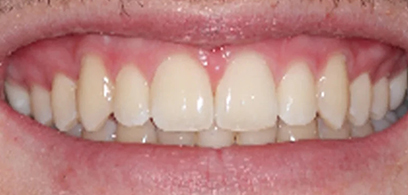 Before & Afters Before & Afters