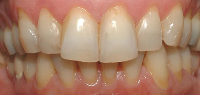 Before & Afters Before & Afters