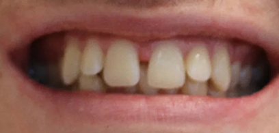 Before & Afters Before & Afters