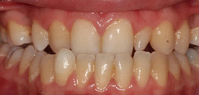 Before & Afters Before & Afters