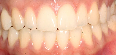 Before & Afters Before & Afters