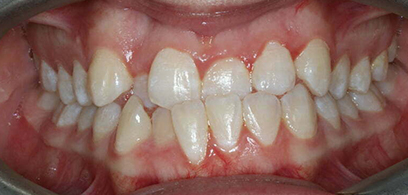 Before & Afters Before & Afters