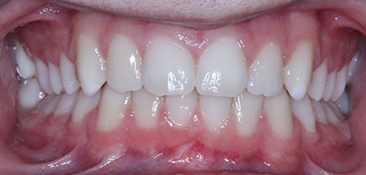 Before & Afters Before & Afters