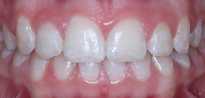 Before & Afters Before & Afters