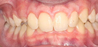 Before & Afters Before & Afters