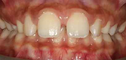 Before & Afters Before & Afters