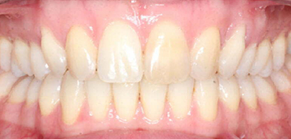 Before & Afters Before & Afters