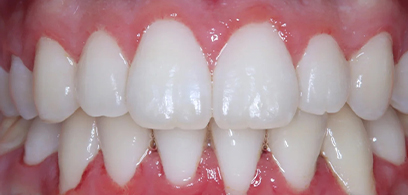 Before & Afters Before & Afters