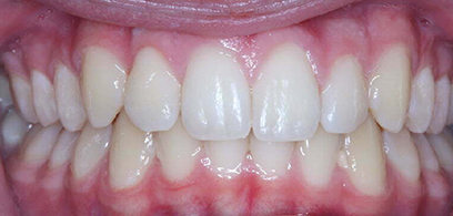 Before & Afters Before & Afters