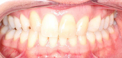 Before & Afters Before & Afters