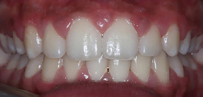 Before & Afters Before & Afters