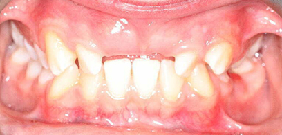 Before & Afters Before & Afters