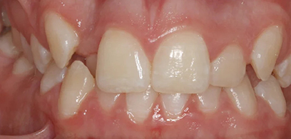 Before & Afters Before & Afters