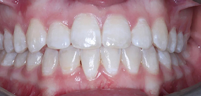 Before & Afters Before & Afters