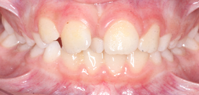 Before & Afters Before & Afters