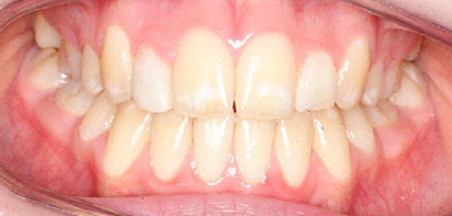 Before & Afters Before & Afters