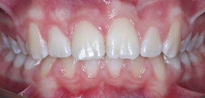 Before & Afters Before & Afters