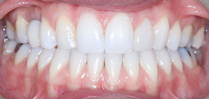 Before & Afters Before & Afters